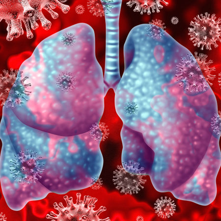 fisioterapia Covid19